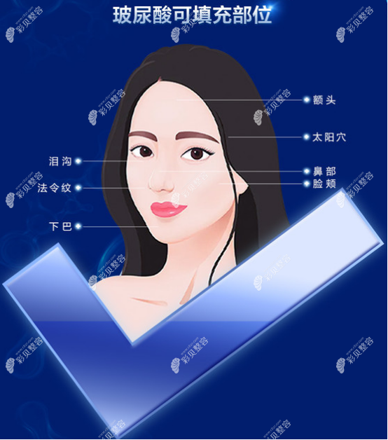 玻尿酸适合填充的部位有哪些