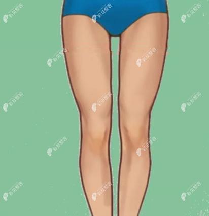 北京禾美嘉做大腿吸脂怎么样