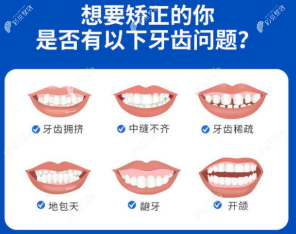武汉优益佳口腔门诊牙齿矫正价格表