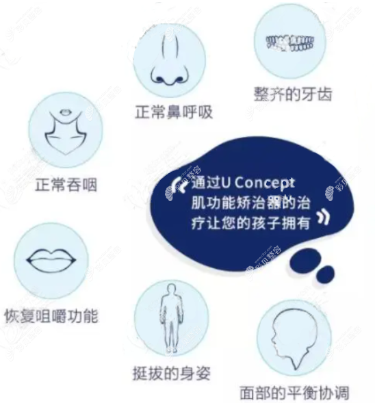 UC牙齿反颌矫正器怎么样