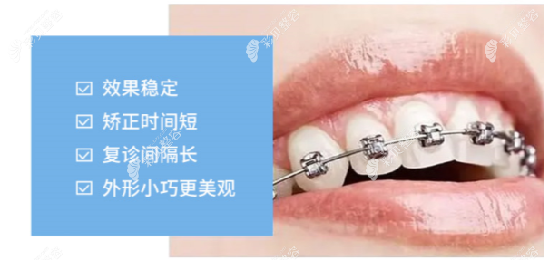 上海鼎植口腔牙齿矫正怎么样www.cbzr.com