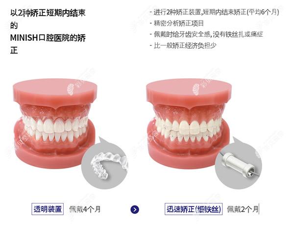 韩国minish口腔医院牙齿矫正怎么样
