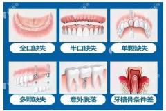 武汉口腔医院价格表:看武汉做种植牙,牙齿矫正,拔牙多少钱