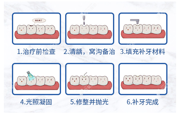 黄石补牙多少钱一颗