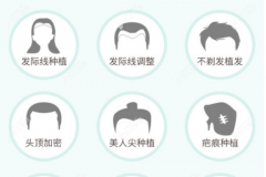 郑州比较有名气的植发医院是碧莲盛,育发和芳艺植发这几家