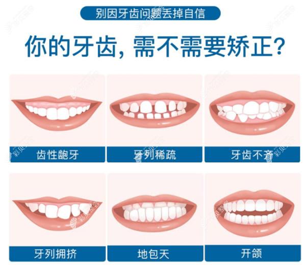 北京维乐口腔矫正牙齿怎么样