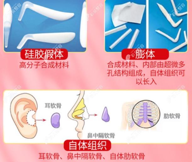王世虎医生做鼻子怎么样