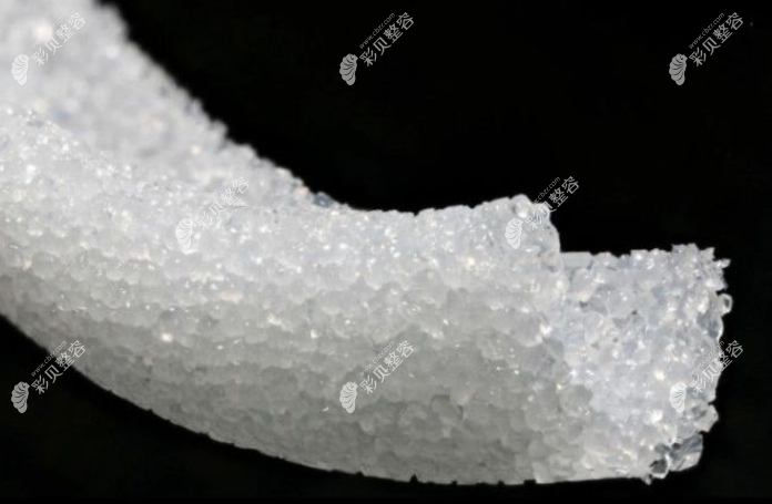 用超肋隆鼻还要取耳软骨吗，超肋鼻为什么还要放耳软骨？