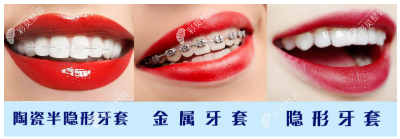 在上海看牙科差不多要花多少钱www.cbzr.com