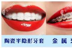 2022上海牙科收费标准,上海种植牙/牙齿矫正等项目价格公示