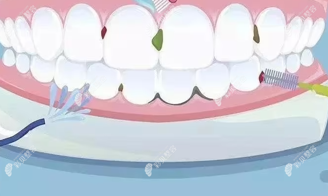 牙槽骨萎缩牙齿松动怎么恢复