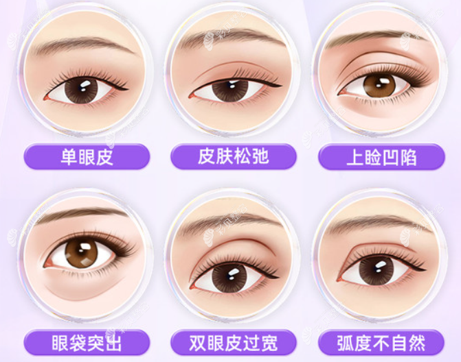 眼综合能改善哪些症状 眼综合能改善哪些症状