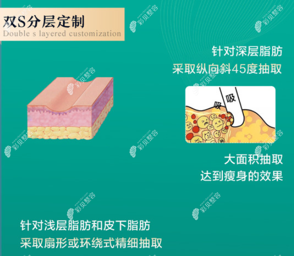 王志军医生吸脂怎么样