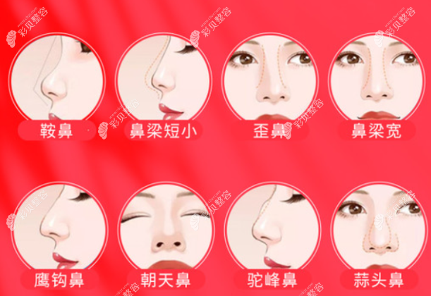 王旭东医生做鼻子怎么样