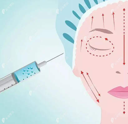 北京美莱整形刘卓医生怎么样www.cbzr.com