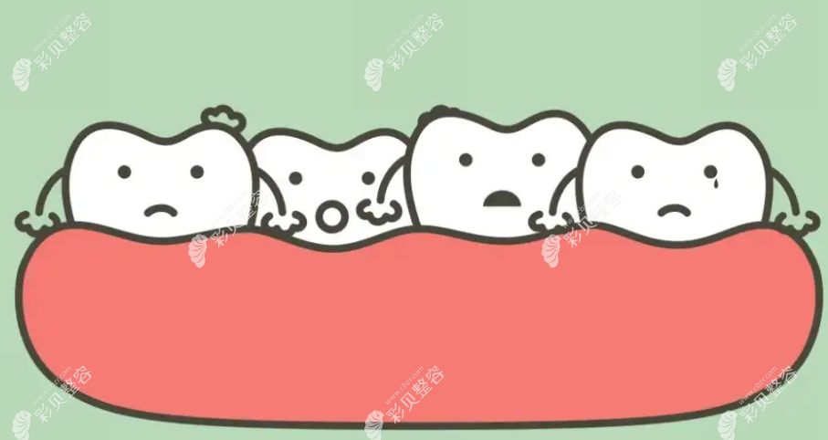 牙不齐能做牙齿贴面改善吗