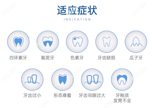 牙齿贴面适合症状有哪些