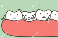 牙不齐能做牙齿贴面改善吗?牙齿贴面适应症状及优缺点解析