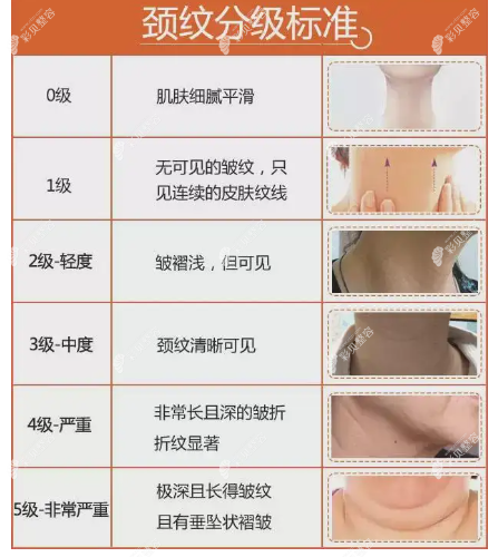 颈纹的去除方法有哪些？www.cbzr.com