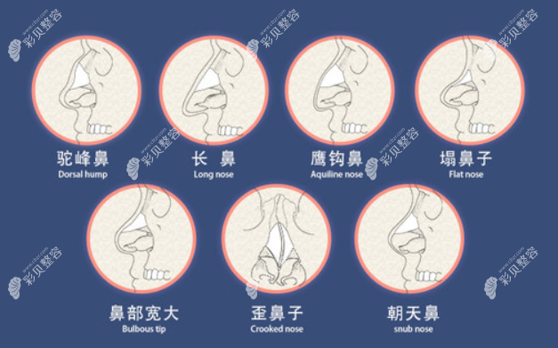 房志强做鼻子的评价怎么样m.cbzr.com