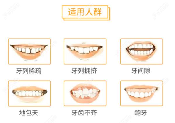 北京京一口腔图片科普牙齿矫正适合人群