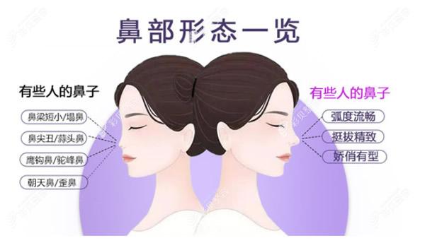 北京沃尔冯雁平医生隆鼻怎么样