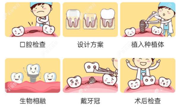 北京齿康达口腔医院手术过程和步骤