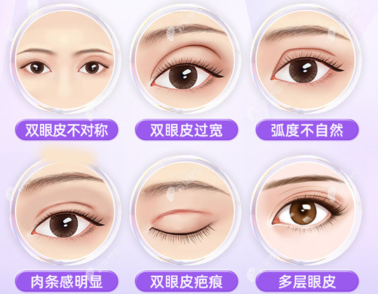 淄博丽美做双眼皮修复好的医生简介,有邹浅医生/张大勇医生