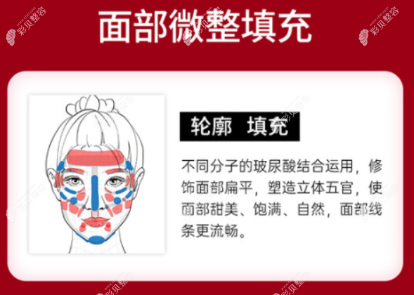 南京打玻尿酸哪个医院好