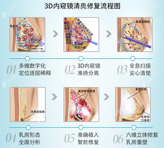 黄广香取奥美定技术优势