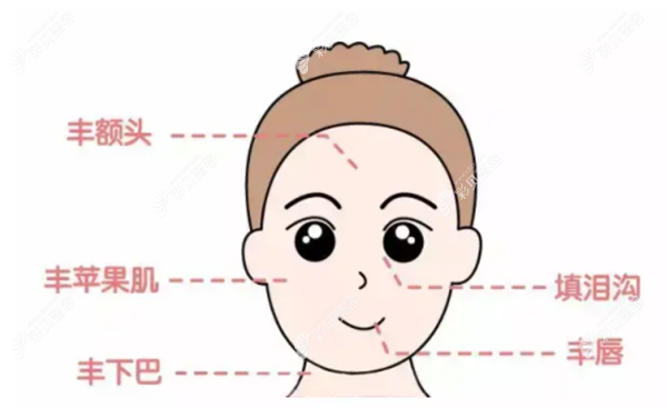 韩国进口德玛玻尿酸适合哪些部位