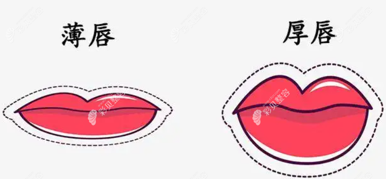 厚唇改薄手术能维持多久www.cbzr.com