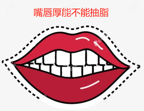 嘴唇厚能不能抽脂,不建议,建议做厚唇改薄手术且价格不贵