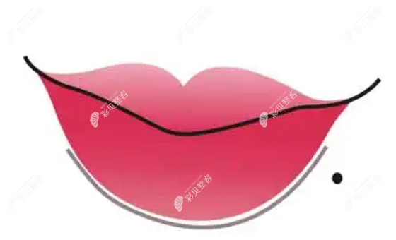 嘴唇厚可以做手术吗