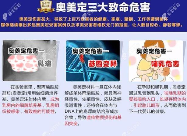 注射奥美定后遗症有哪些