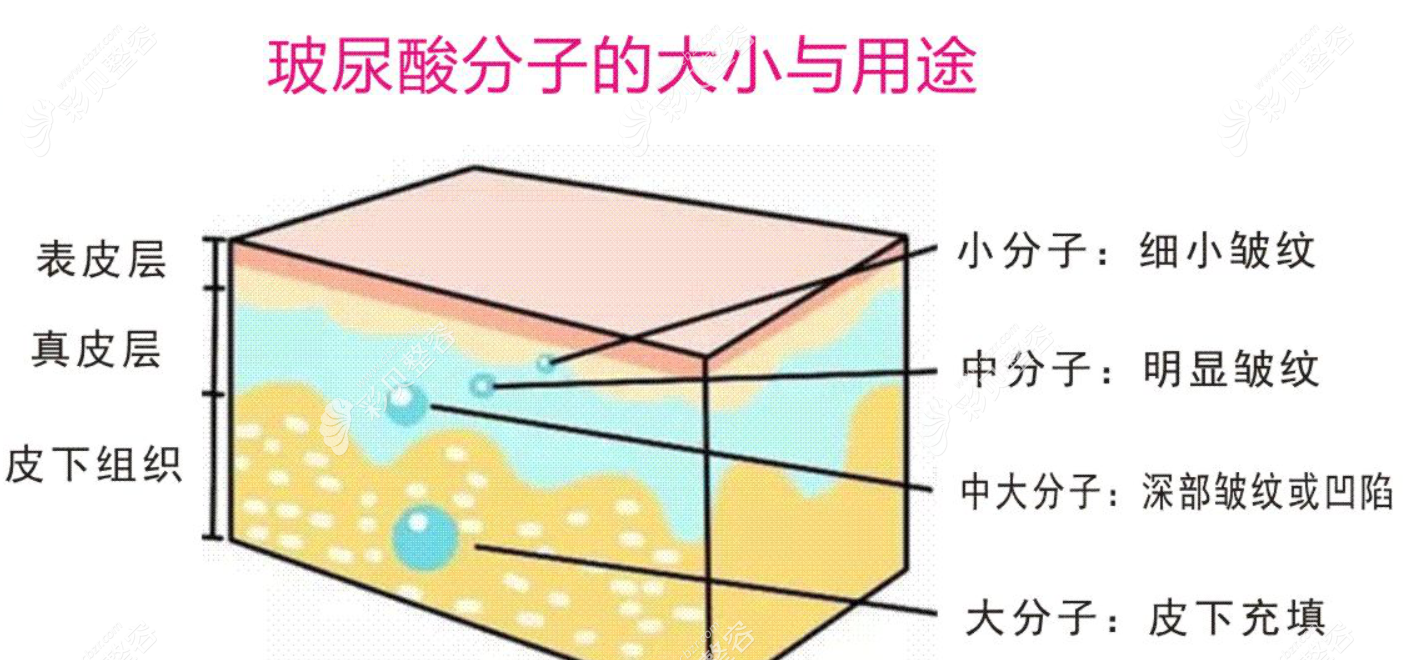 玻尿酸大中小分子功效和作用图解