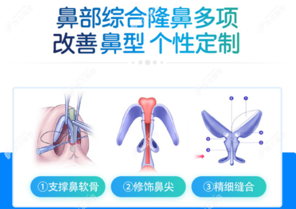 杨水斌医生隆鼻口碑好吗