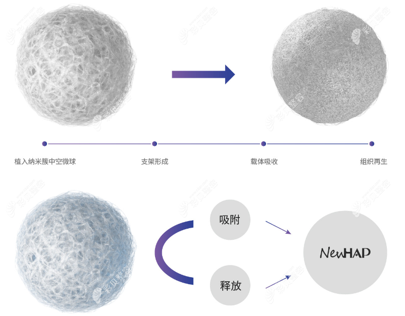 悦龄塑冰冰针维持时间及补打周期