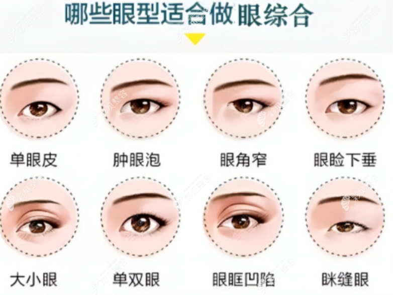 无锡万佳整形好的医生李东旭做眼睛怎么样