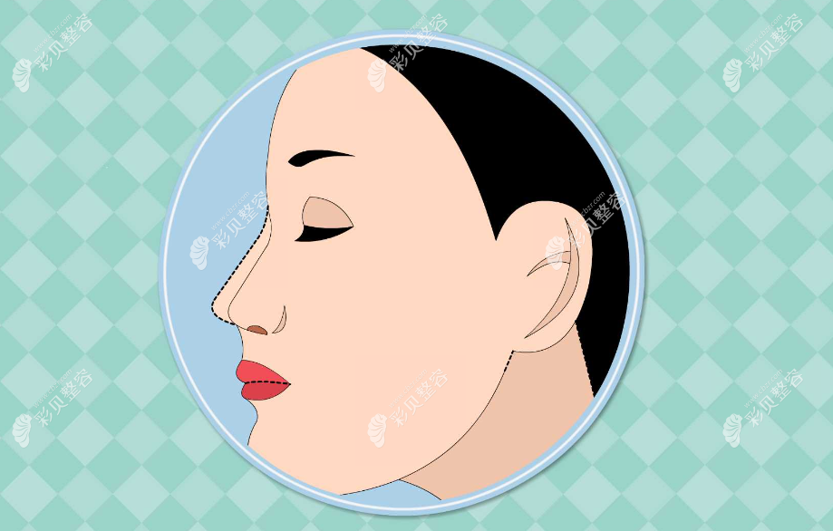 性价比高的隆鼻医生推荐