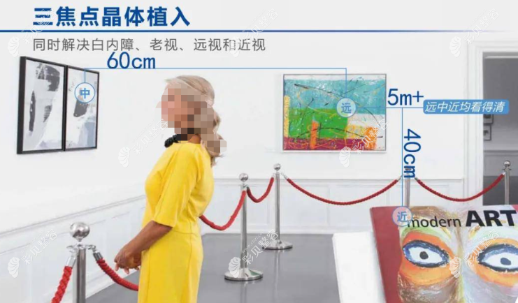 爱尔康三焦点人工晶体怎么样