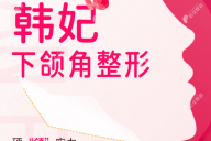 广州韩妃整形医院磨骨价格:预约柳超做下颌角截骨费用3万起